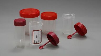 How to prepare for parasitic testing